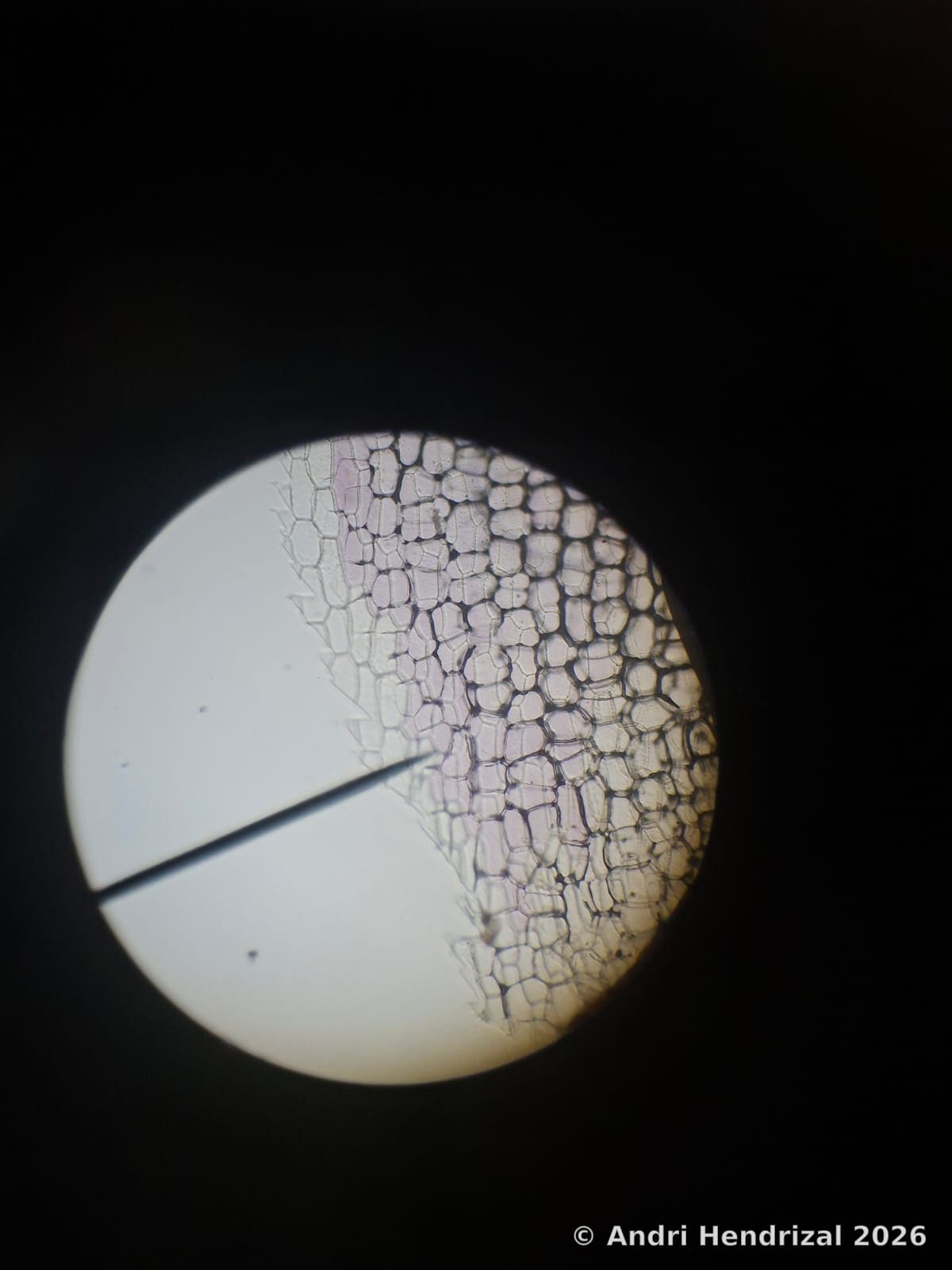 Shallot skin